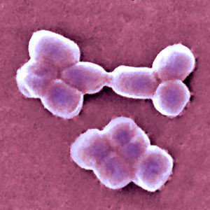 Scalar energy disassembles the bacterium, ACINETOBACTER BAUMANII that infects the human body.