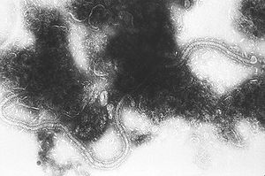 Respiratory Syncytial Virus Disassembled by Scalar Energy