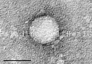 Hepatitis C Virus is disassembled via the scalar energy pathogenic cleanse.