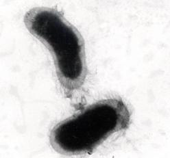 Bartonella Henselae is disassembled by scalar energy therby providing relief from Lyme Disease. Every scalar energy pathogenic cleanse serves to disassemble Bartonella henselae as well as other co-infections of Lyme disease.