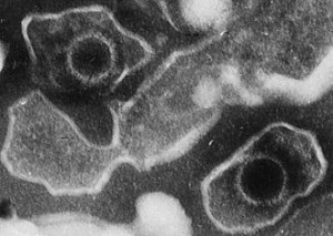 Epstein Barr virus disassembled by scalar energy