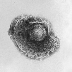 The Varicella Zoster virus is disassembled via the scalar energy pathogenic cleanse.