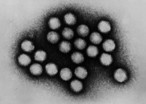 ADENOVIRUS