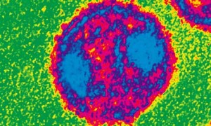 TEM of the HIV Virus used in the pathogen cleanse.