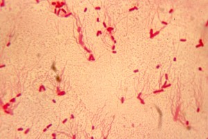 Scalar Energy disassembles and eradicates Salmonella Typhi, the causative agent of Typhoid Fever.