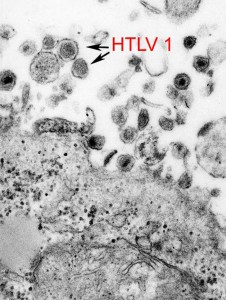 Human T-Lymphotropic Virus disassembled via pathogen cleanse.